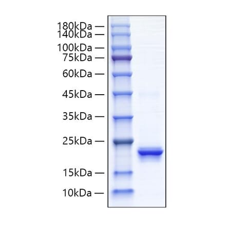 SDS-PAGE - Recombinant Human IFNA4 Protein (C-terminal His Tag) (A330765) - Antibodies.com