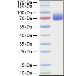 SDS-PAGE - Recombinant Human IFNAR2 Protein (C-terminal Human Fc and His Tag) (A330768) - Antibodies.com