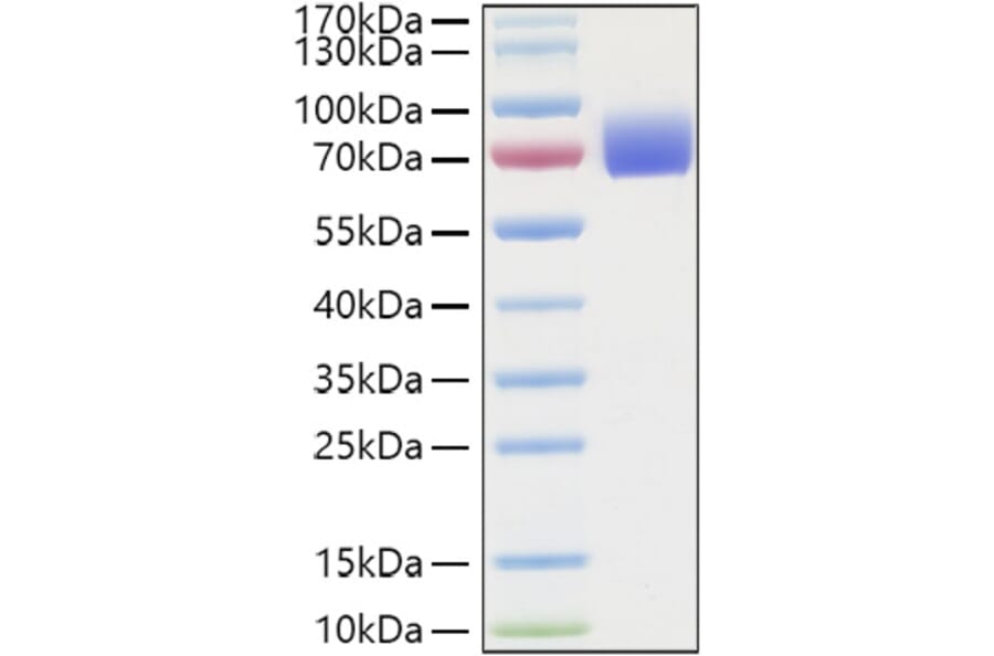 SDS-PAGE - Recombinant Human IFNAR2 Protein (C-terminal Human Fc and His Tag) (A330768) - Antibodies.com