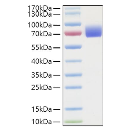 SDS-PAGE - Recombinant Human IFNAR2 Protein (C-terminal Human Fc and His Tag) (A330768) - Antibodies.com