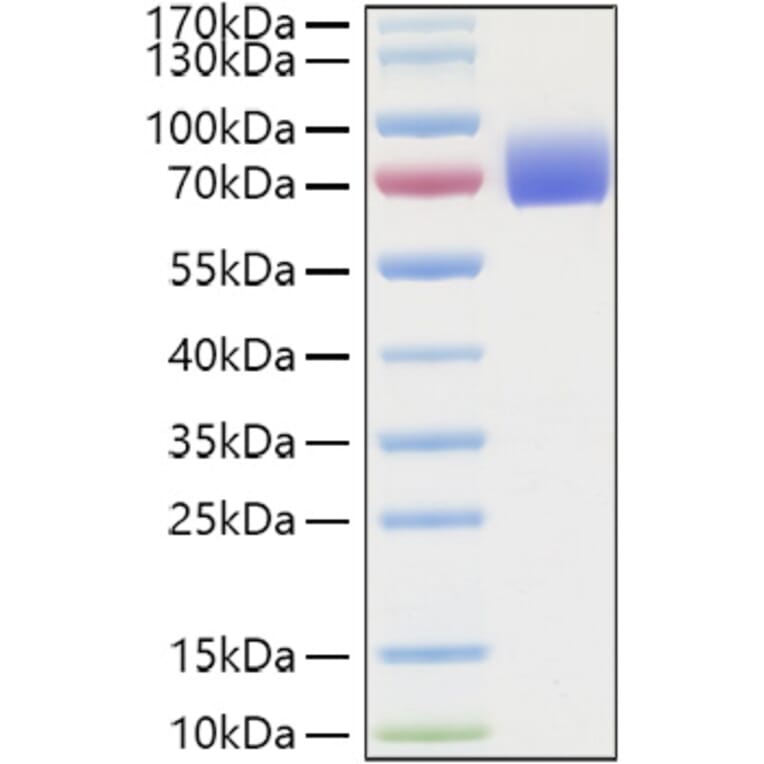 SDS-PAGE - Recombinant Human IFNAR2 Protein (C-terminal Human Fc and His Tag) (A330768) - Antibodies.com