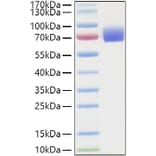 SDS-PAGE - Recombinant Human IFNAR2 Protein (C-terminal Human Fc and His Tag) (A330768) - Antibodies.com