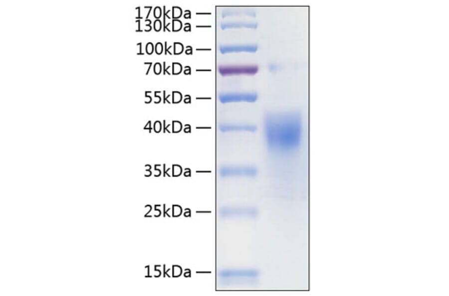 SDS-PAGE - Recombinant Human IFNGR1 Protein (C-terminal His Tag) (A330769) - Antibodies.com