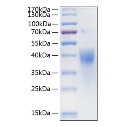 SDS-PAGE - Recombinant Human IFNGR1 Protein (C-terminal His Tag) (A330769) - Antibodies.com