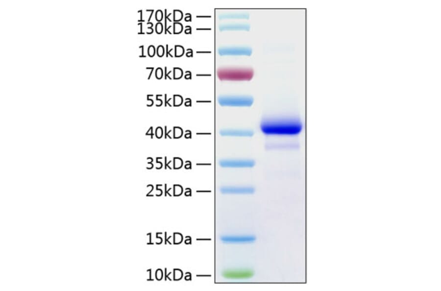 SDS-PAGE - Recombinant Human IGF1 Protein (C-terminal Human Fc and His Tag) (A330770) - Antibodies.com