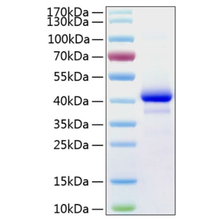 SDS-PAGE - Recombinant Human IGF1 Protein (C-terminal Human Fc and His Tag) (A330770) - Antibodies.com