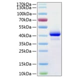 SDS-PAGE - Recombinant Human IGF1 Protein (C-terminal Human Fc and His Tag) (A330770) - Antibodies.com