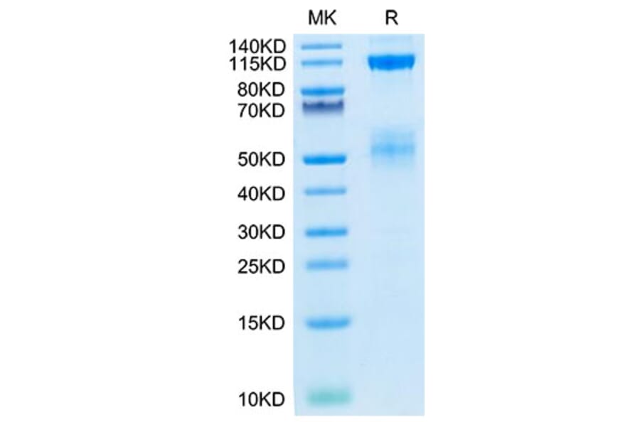 Tris-Bis PAGE - Recombinant Human IGF1R Protein (Biotin) (C-terminal His and Avi Tag) (A330773) - Antibodies.com