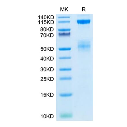 Tris-Bis PAGE - Recombinant Human IGF1R Protein (Biotin) (C-terminal His and Avi Tag) (A330773) - Antibodies.com
