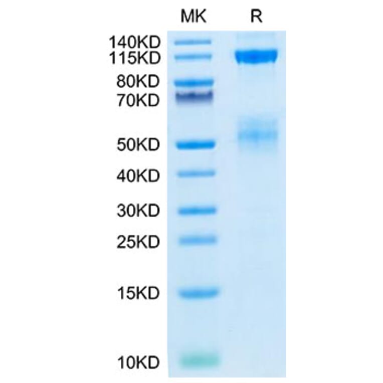 Tris-Bis PAGE - Recombinant Human IGF1R Protein (Biotin) (C-terminal His and Avi Tag) (A330773) - Antibodies.com