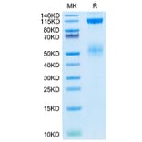 Tris-Bis PAGE - Recombinant Human IGF1R Protein (Biotin) (C-terminal His and Avi Tag) (A330773) - Antibodies.com