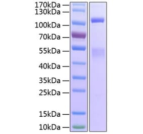 SDS-PAGE - Recombinant Human IGF1R Protein (C-terminal His Tag) (A330774) - Antibodies.com