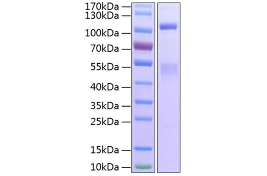 SDS-PAGE - Recombinant Human IGF1R Protein (C-terminal His Tag) (A330774) - Antibodies.com