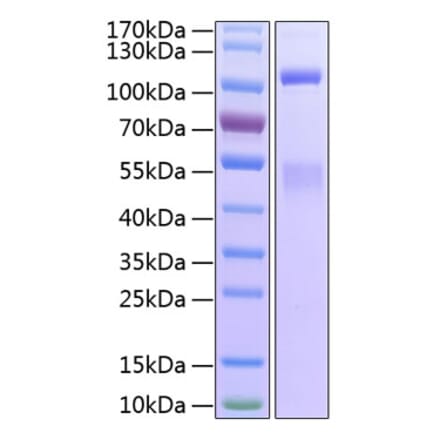 SDS-PAGE - Recombinant Human IGF1R Protein (C-terminal His Tag) (A330774) - Antibodies.com