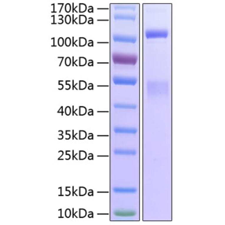 SDS-PAGE - Recombinant Human IGF1R Protein (C-terminal His Tag) (A330774) - Antibodies.com