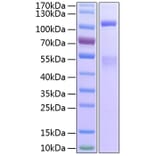 SDS-PAGE - Recombinant Human IGF1R Protein (C-terminal His Tag) (A330774) - Antibodies.com