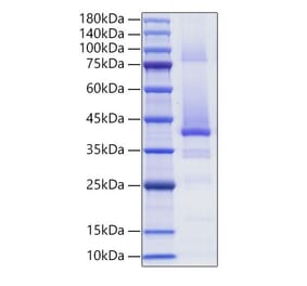 SDS-PAGE - Recombinant Human IGF2 Protein (C-terminal Human Fc Tag) (A330775) - Antibodies.com