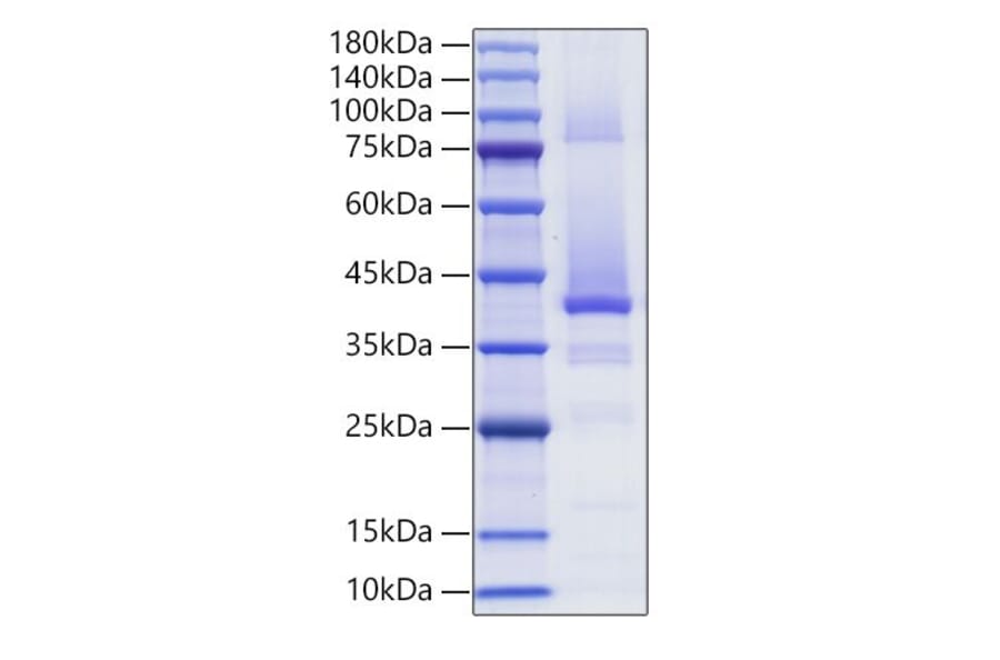 SDS-PAGE - Recombinant Human IGF2 Protein (C-terminal Human Fc Tag) (A330775) - Antibodies.com
