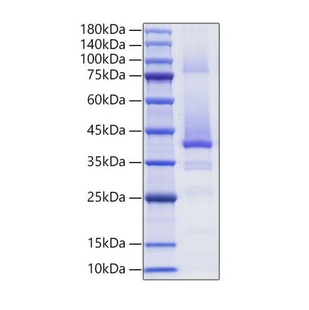 SDS-PAGE - Recombinant Human IGF2 Protein (C-terminal Human Fc Tag) (A330775) - Antibodies.com