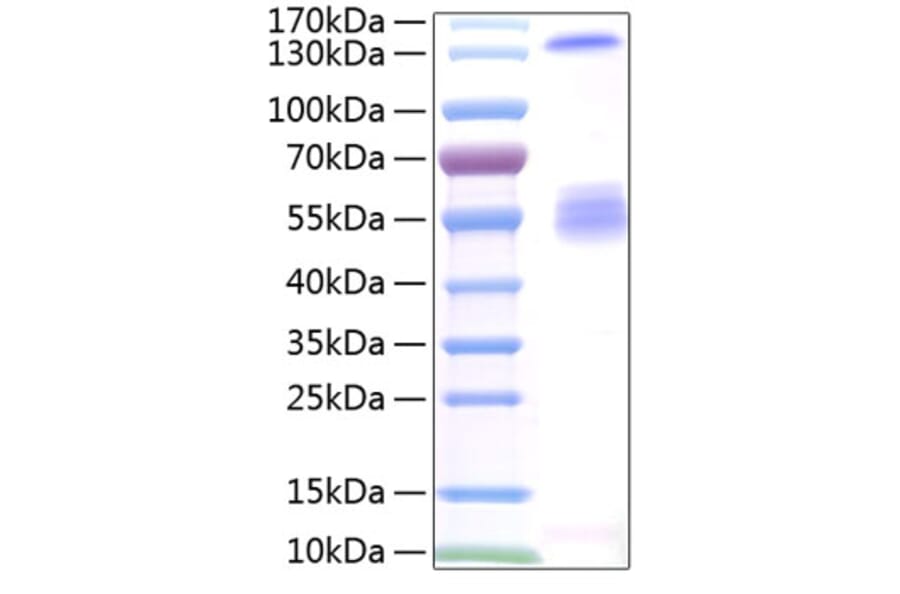 SDS-PAGE - Recombinant Human IGF2BP2 Protein (N-terminal T7 and C-terminal His Tag) (A330776) - Antibodies.com