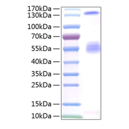 SDS-PAGE - Recombinant Human IGF2BP2 Protein (N-terminal T7 and C-terminal His Tag) (A330776) - Antibodies.com