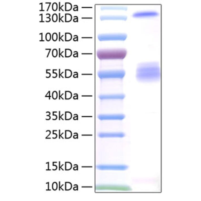 SDS-PAGE - Recombinant Human IGF2BP2 Protein (N-terminal T7 and C-terminal His Tag) (A330776) - Antibodies.com