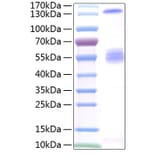 SDS-PAGE - Recombinant Human IGF2BP2 Protein (N-terminal T7 and C-terminal His Tag) (A330776) - Antibodies.com