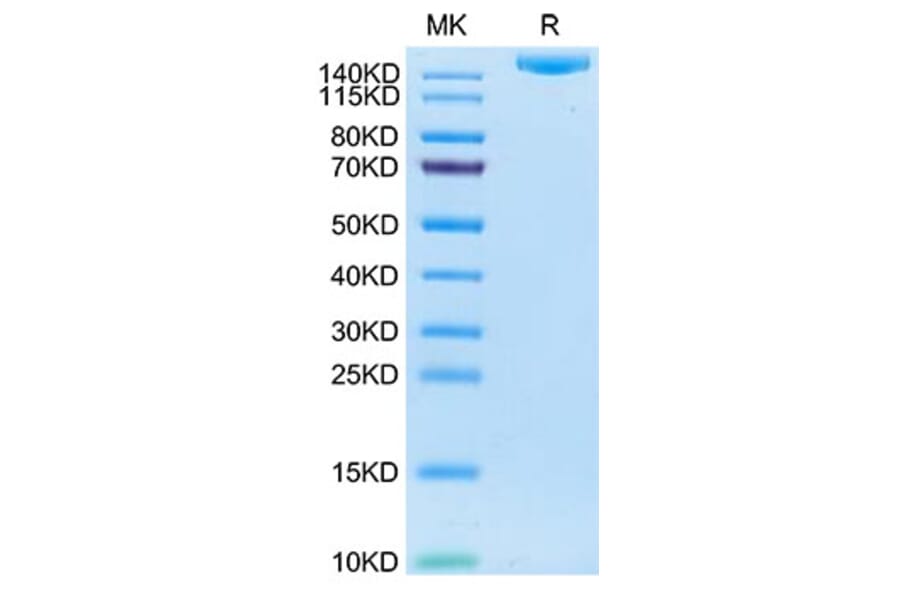 SDS-PAGE - Recombinant Human IGF2R Protein (C-terminal His and Avi Tag) (A330777) - Antibodies.com