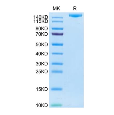 SDS-PAGE - Recombinant Human IGF2R Protein (C-terminal His and Avi Tag) (A330777) - Antibodies.com