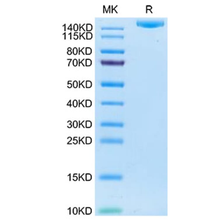 SDS-PAGE - Recombinant Human IGF2R Protein (C-terminal His and Avi Tag) (A330777) - Antibodies.com