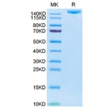 SDS-PAGE - Recombinant Human IGF2R Protein (C-terminal His and Avi Tag) (A330777) - Antibodies.com