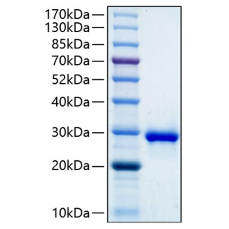 SDS-PAGE - Recombinant Human IGFBP1 Protein (C-terminal His Tag) (A330778) - Antibodies.com