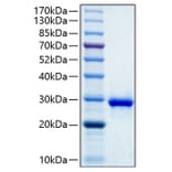 SDS-PAGE - Recombinant Human IGFBP1 Protein (C-terminal His Tag) (A330778) - Antibodies.com