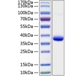 SDS-PAGE - Recombinant Human IGFBP2 Protein (C-terminal His Tag) (A330779) - Antibodies.com
