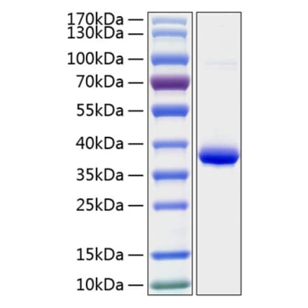 SDS-PAGE - Recombinant Human IGFBP2 Protein (C-terminal His Tag) (A330779) - Antibodies.com