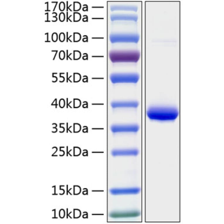 SDS-PAGE - Recombinant Human IGFBP2 Protein (C-terminal His Tag) (A330779) - Antibodies.com