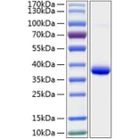 SDS-PAGE - Recombinant Human IGFBP2 Protein (C-terminal His Tag) (A330779) - Antibodies.com