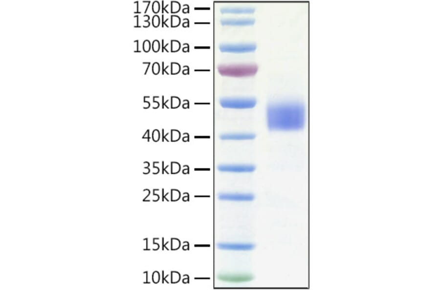 SDS-PAGE - Recombinant Human IGFBP3 Protein (C-terminal His Tag) (A330780) - Antibodies.com