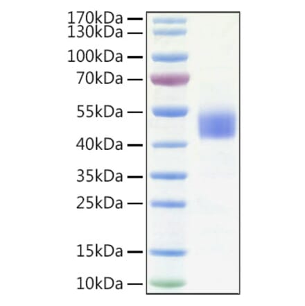SDS-PAGE - Recombinant Human IGFBP3 Protein (C-terminal His Tag) (A330780) - Antibodies.com
