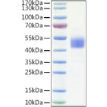 SDS-PAGE - Recombinant Human IGFBP3 Protein (C-terminal His Tag) (A330780) - Antibodies.com