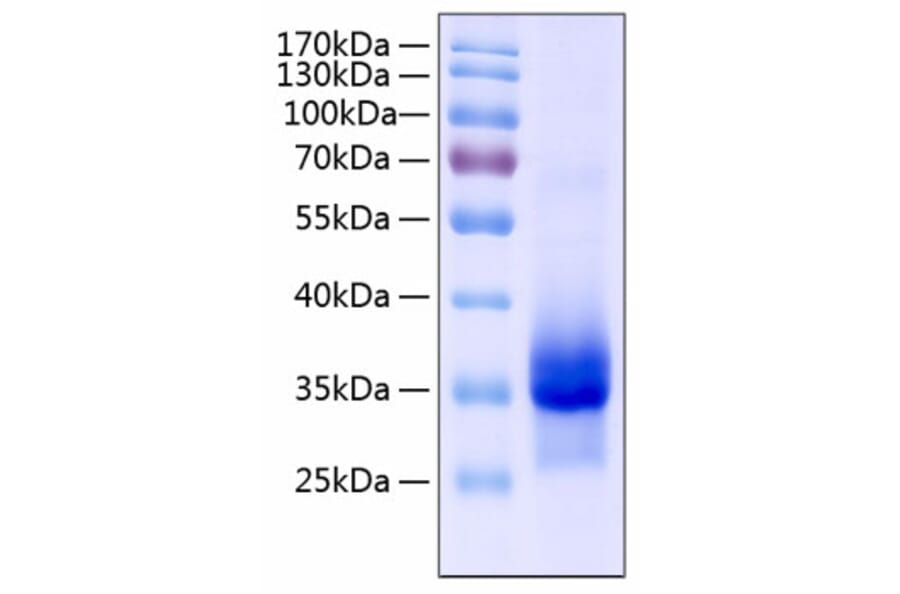 SDS-PAGE - Recombinant Human IGFBP4 Protein (C-terminal His Tag) (A330781) - Antibodies.com