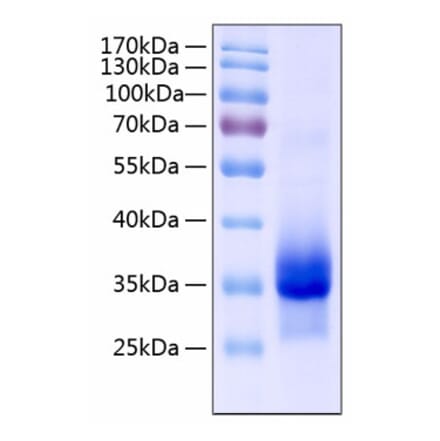 SDS-PAGE - Recombinant Human IGFBP4 Protein (C-terminal His Tag) (A330781) - Antibodies.com