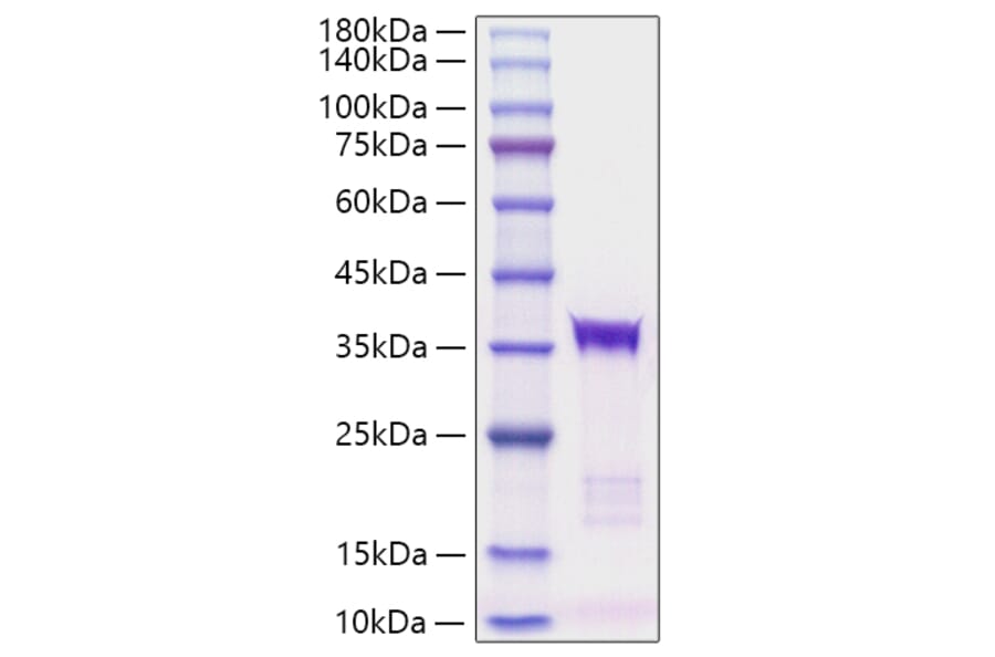 SDS-PAGE - Recombinant human IGFBP5 Protein (C-terminal His Tag) (A330782) - Antibodies.com