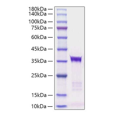 SDS-PAGE - Recombinant human IGFBP5 Protein (C-terminal His Tag) (A330782) - Antibodies.com