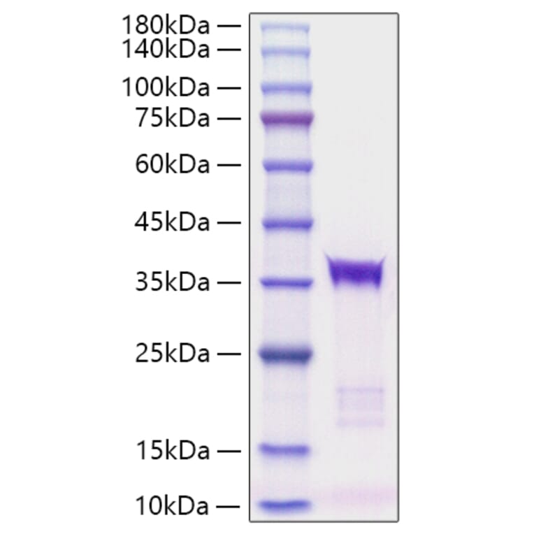 SDS-PAGE - Recombinant human IGFBP5 Protein (C-terminal His Tag) (A330782) - Antibodies.com