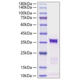 SDS-PAGE - Recombinant human IGFBP5 Protein (C-terminal His Tag) (A330782) - Antibodies.com