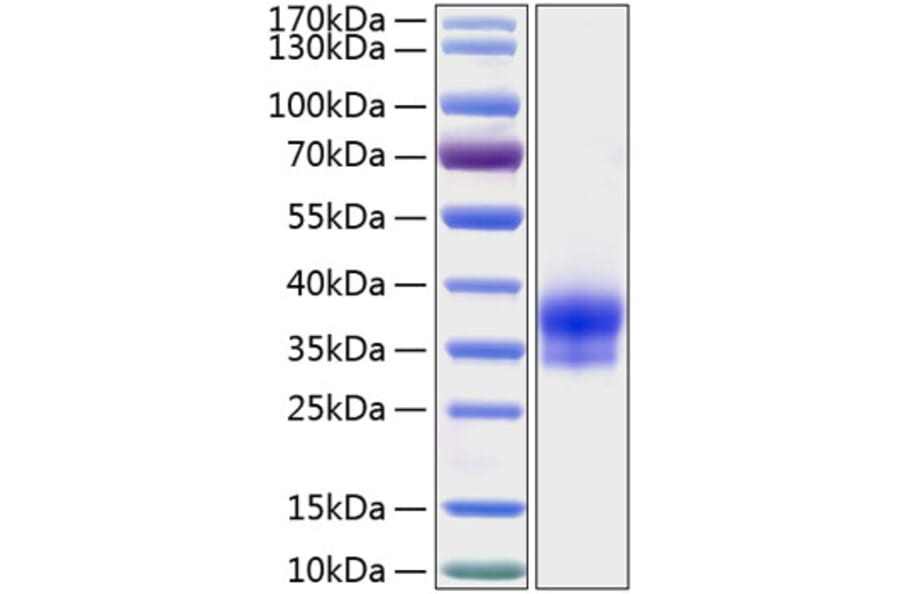 SDS-PAGE - Recombinant Human IGFBP6 Protein (C-terminal His Tag) (A330783) - Antibodies.com