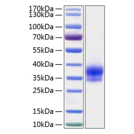 SDS-PAGE - Recombinant Human IGFBP6 Protein (C-terminal His Tag) (A330783) - Antibodies.com