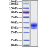 SDS-PAGE - Recombinant Human IGFBP6 Protein (C-terminal His Tag) (A330783) - Antibodies.com