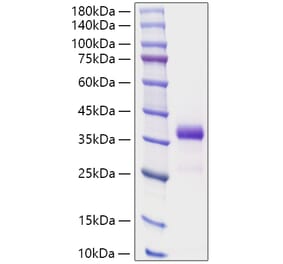 SDS-PAGE - Recombinant Human IGFBP7 Protein (N-terminal His Tag) (A330784) - Antibodies.com
